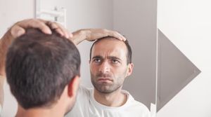 Hair Transplant Explained: Knowledge, Tips, and Helpful Resources