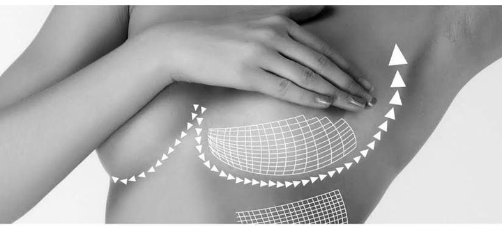 Explore Non-Surgical Breast Firming: Modern Techniques and Practical Insights